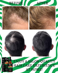AKBAN mezcla romero batana en aceite, aroma fresco para el cabello