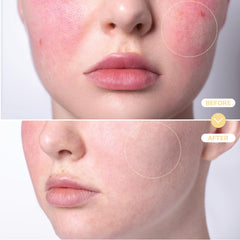 BASE LABORATORIES tónico facial en spray, limpieza suave y equilibrante.