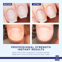 Blue Cross crema suavizante de cutículas para dedos que facilita la preparación de uñas.