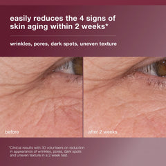 Dermalogica suero retinoide, poros más pequeños y piel más clara.