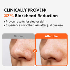 Hanskin AHA Pore Cleansing Oil, limpieza de poros profunda para piel limpia