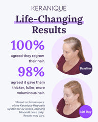 Keranique Applying Dropper to Scalp demonstrates mess-free routine.
