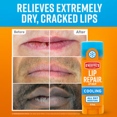 Barra Lip Repair brinda protección duradera con acción calmante.