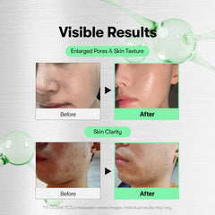 VT COSMETICS CICA Reedle Shot 700: aplicación en piel limpia para renovación suave.