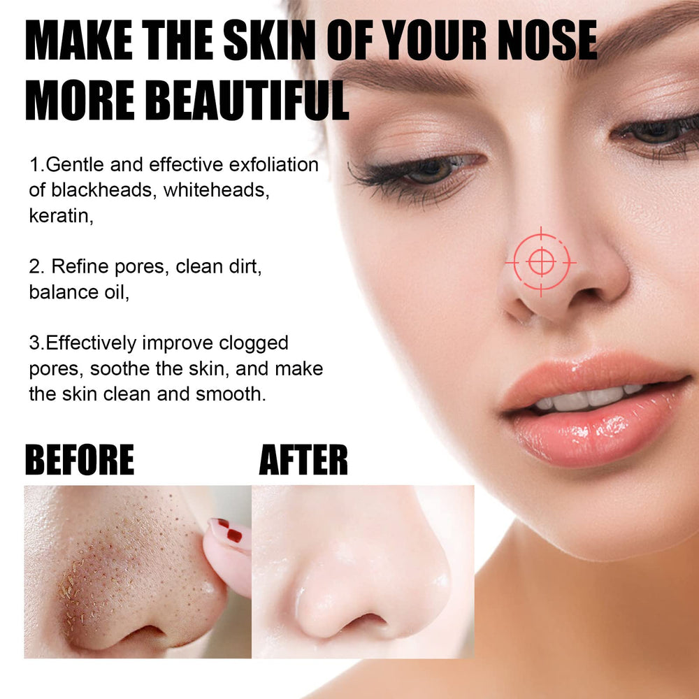 Aacnre Centella mask offers oil-control potential for clearer skin