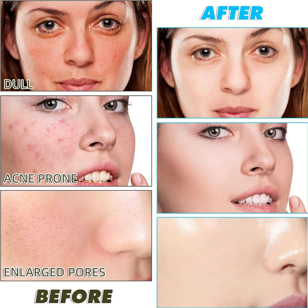 Aacnre exfoliante cúrcuma, cuidado diario para rostro y cuerpo.