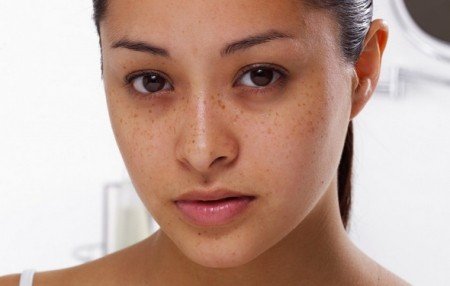Application de la crème ACM Depiwhite sur le visage