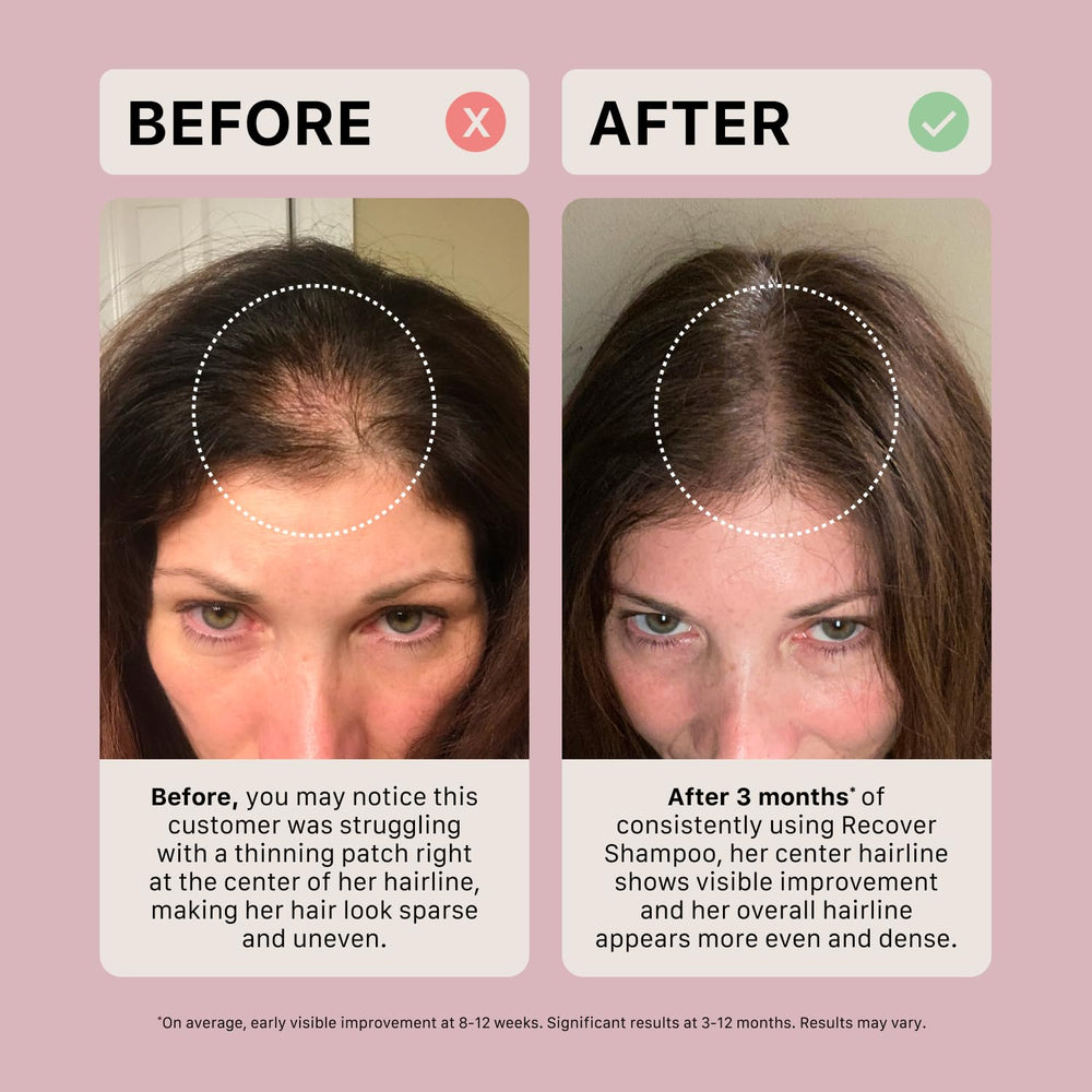ACTIIV Recover fórmula de base vegetal vegana, cuidado respetuoso con el cabello.