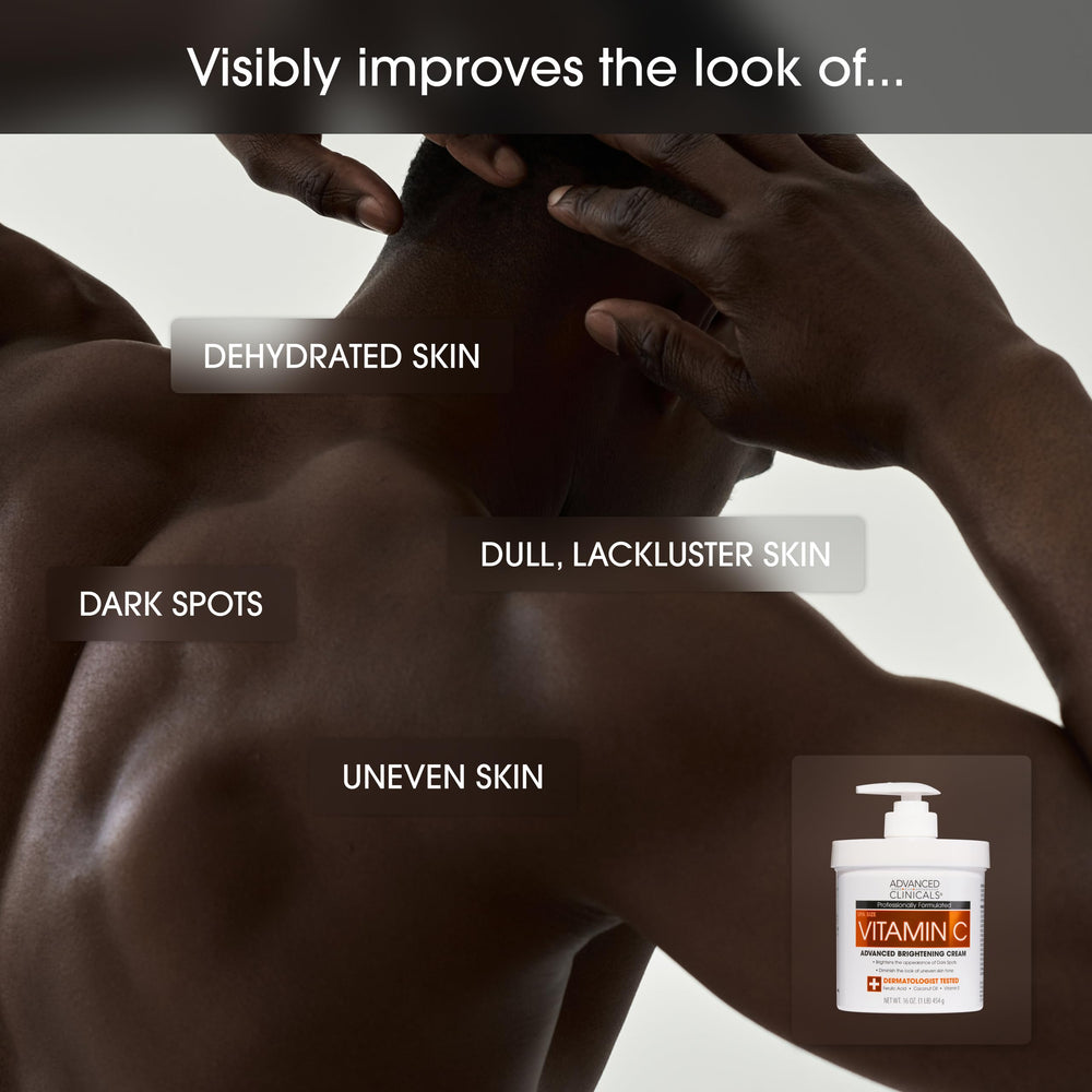 Advanced Clinicals crema vitamina-c tono uniforme para manchas visibles reducidas.