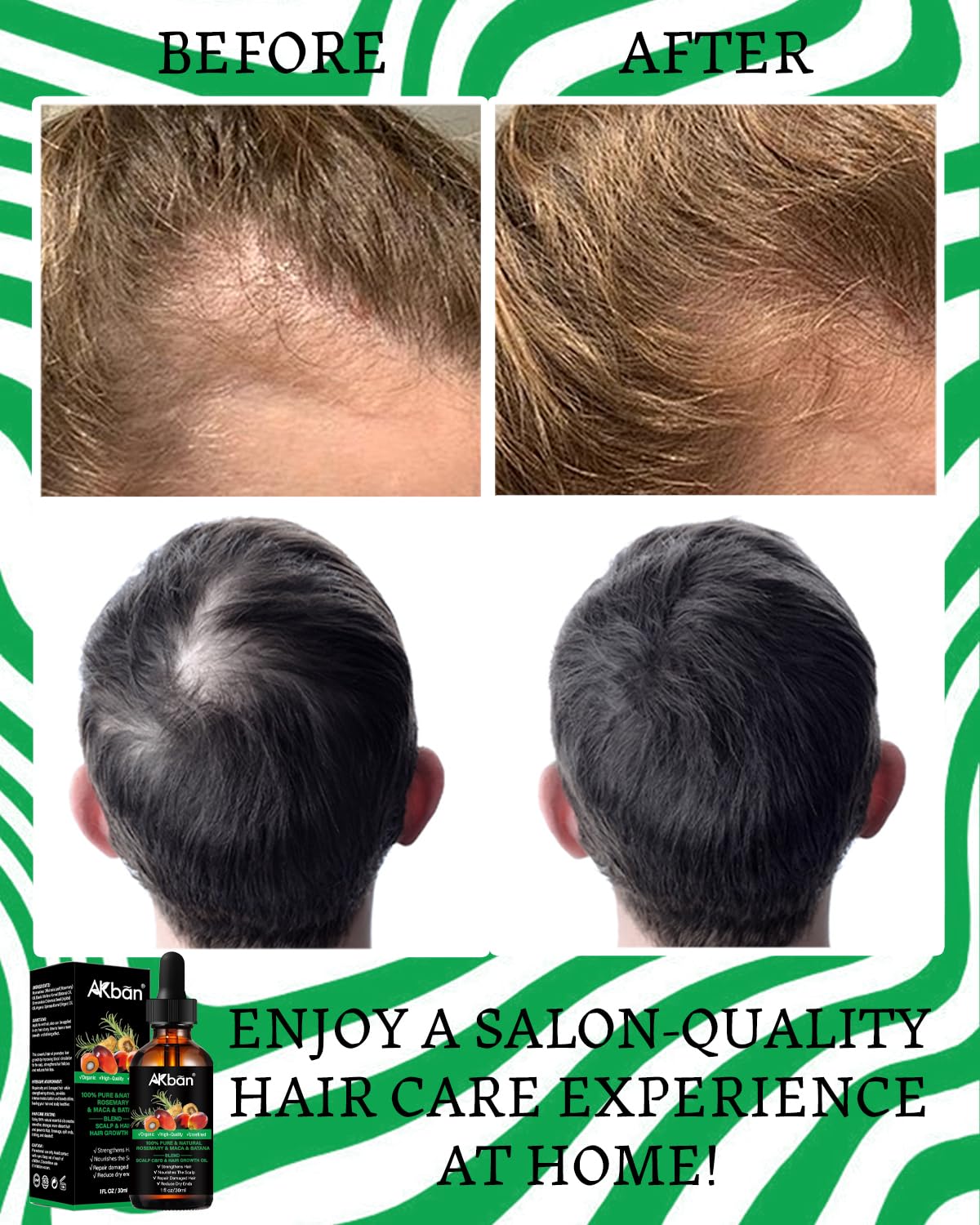 AKBAN mezcla romero batana en aceite, aroma fresco para el cabello
