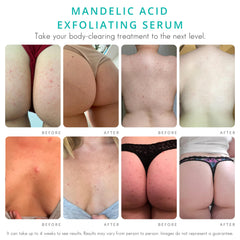 Textura cremosa de Almond Clear Serum con ácido mandélico