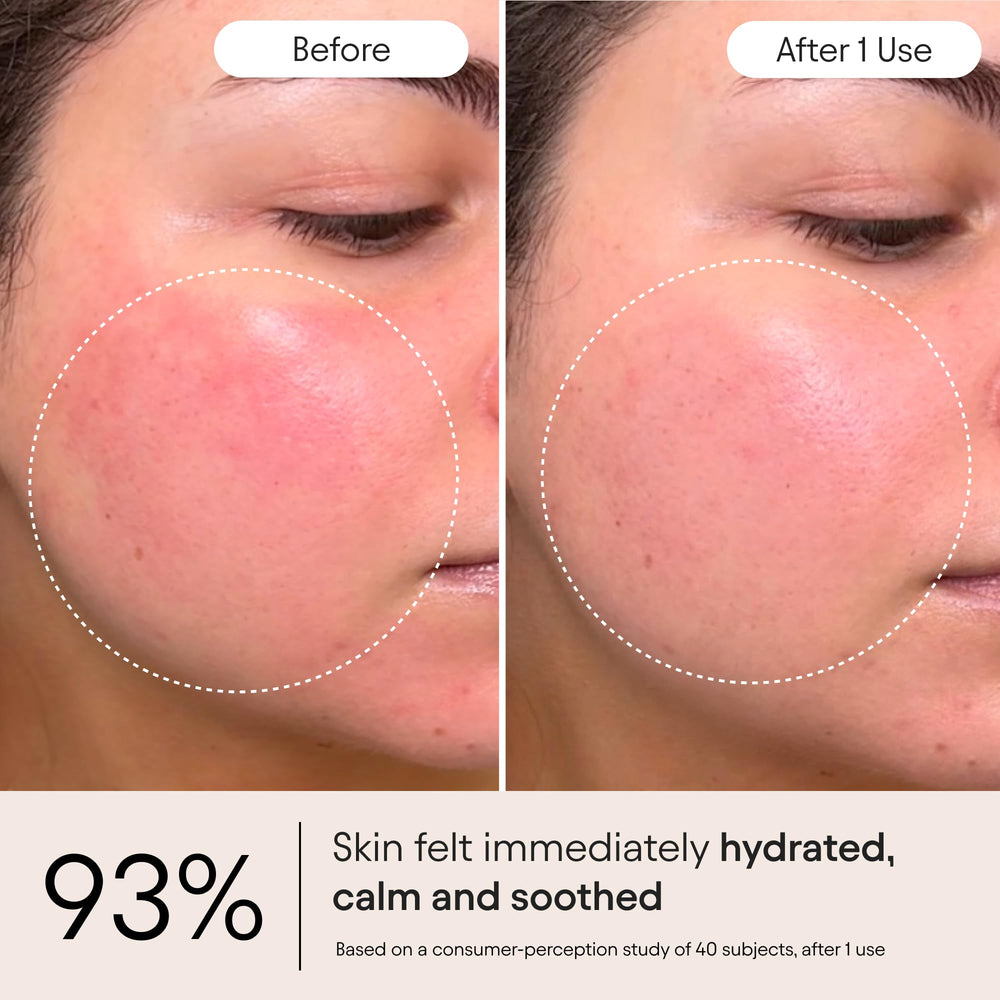 Alpyn Ghostberry, frasco, calma enrojecimiento e irritación en piel sensible.