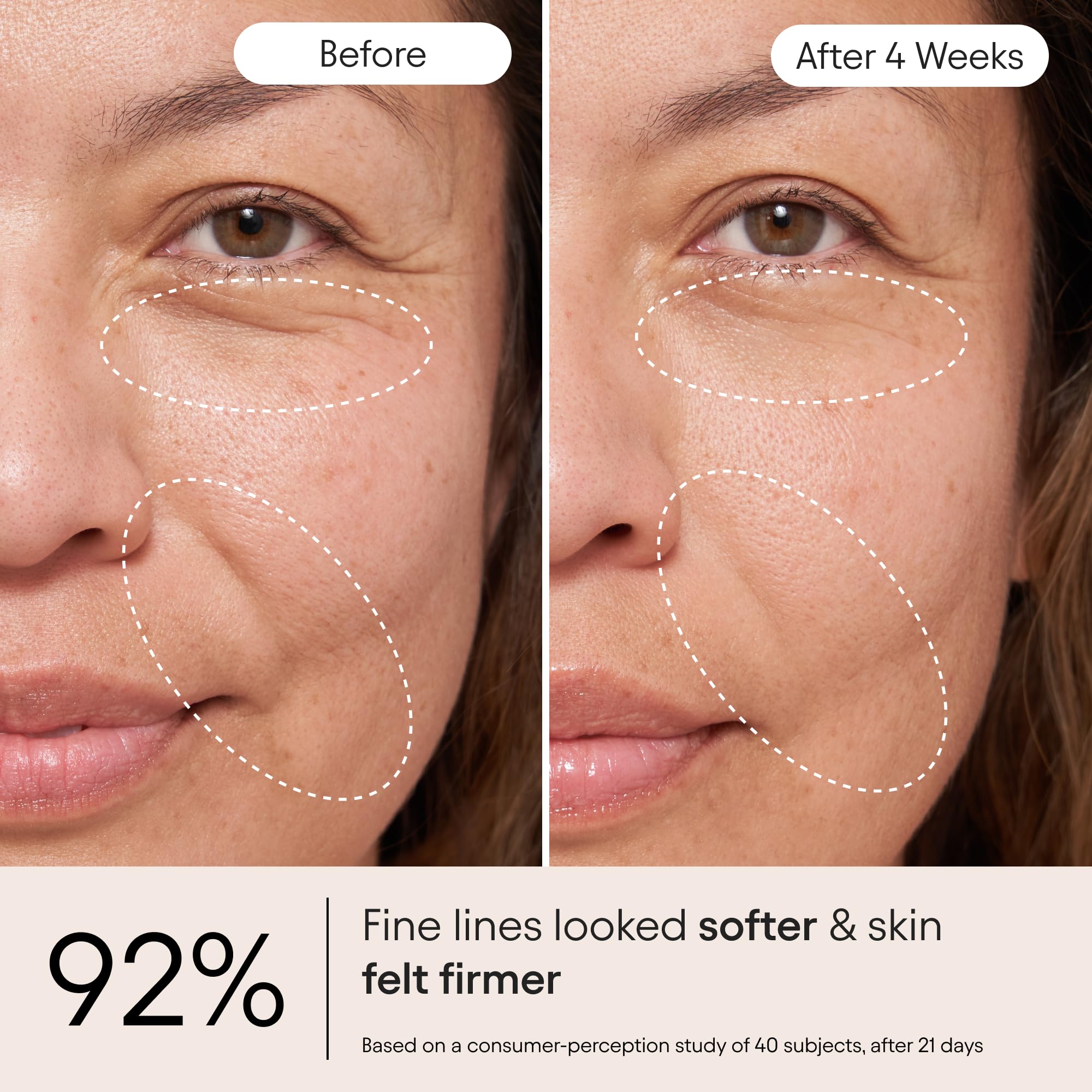 Alpyn Snap8, crema, reduce visiblemente líneas de expresión.
