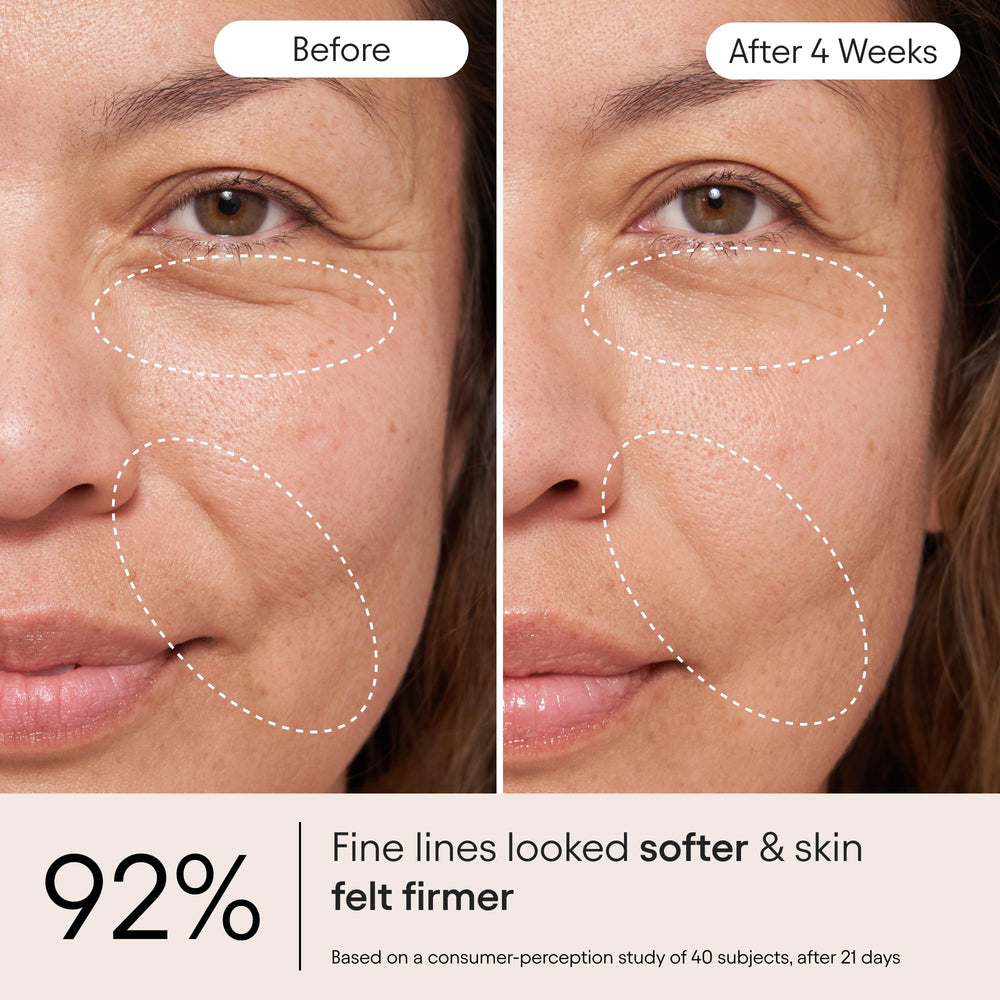 Alpyn Snap8, crema, reduce visiblemente líneas de expresión.