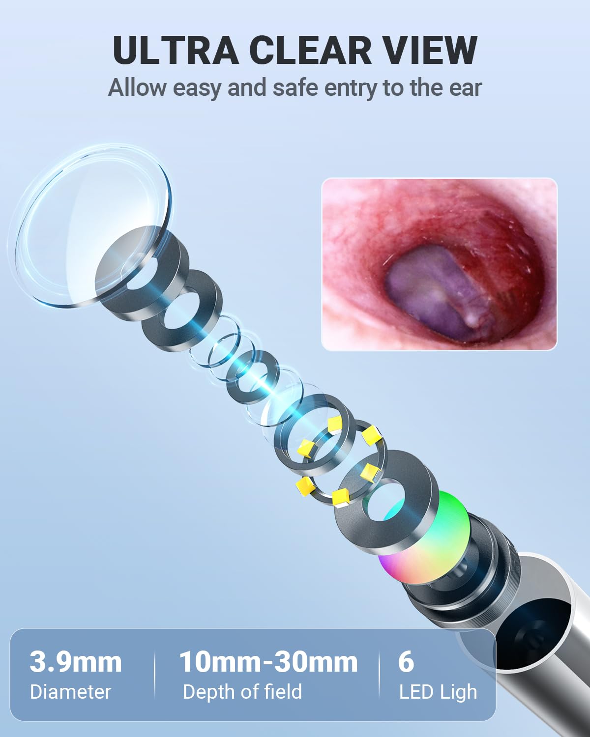Anykit otoscope includes 32GB memory card for media capture.