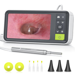 Anykit otoscope gyroscope view for stable, clear ear canal images.