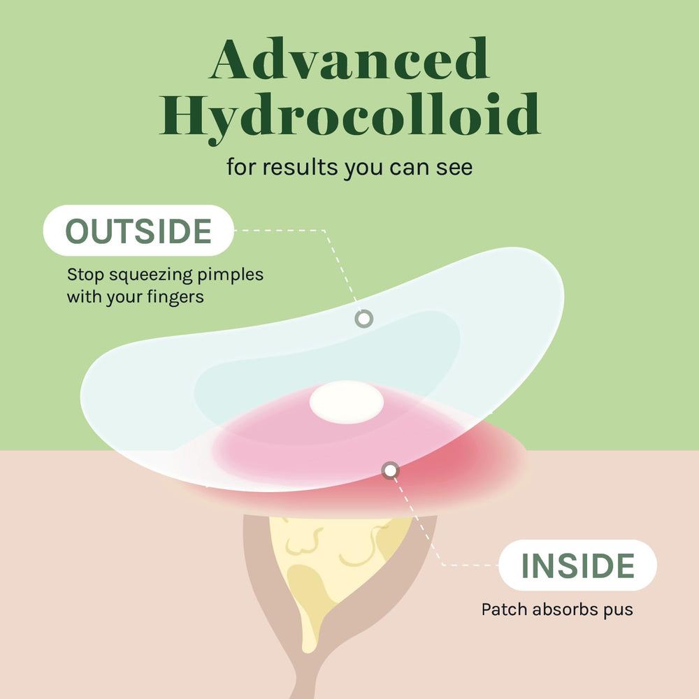 AOA Studio hydrocolloid patch 12mm close-up highlighting two size option.