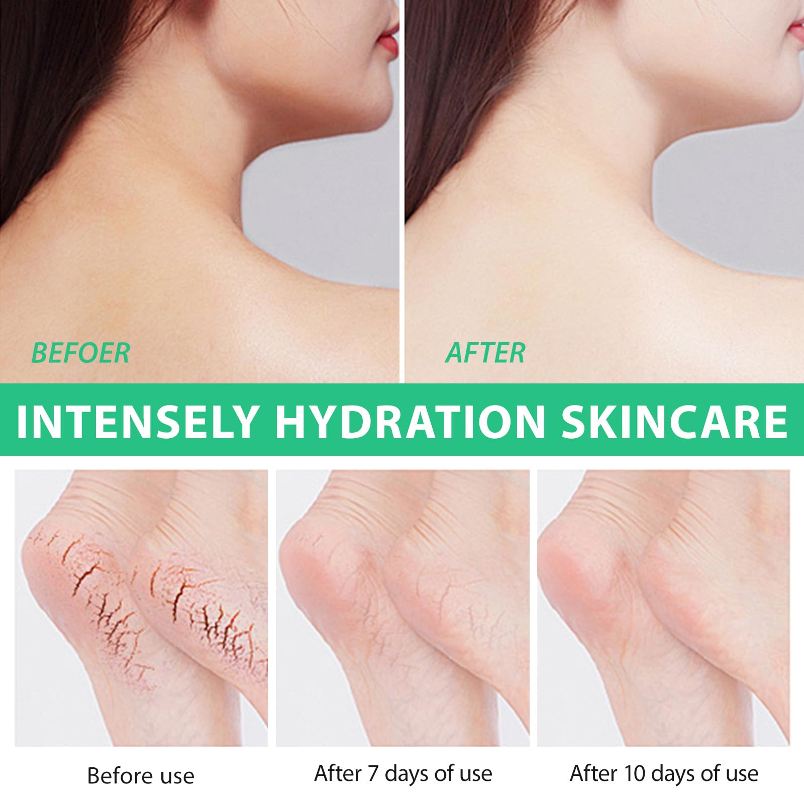 ARBCRN crema de urea 40% con aloe vera para manos.