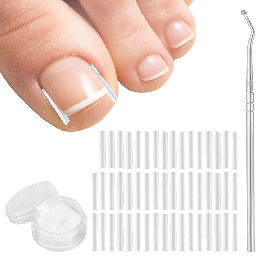 Aster corrector uñas encarnadas: guía suave para el crecimiento