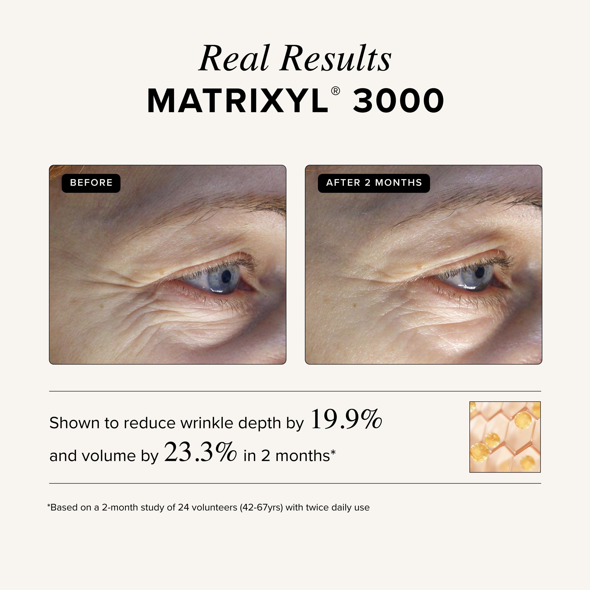Asterwood Matrixyl 3000 + Argireline: hidratación diaria para una piel nutrida.