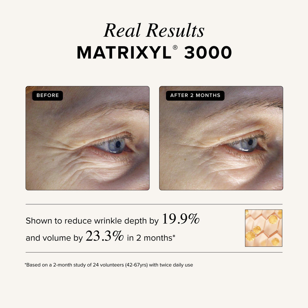Asterwood Matrixyl 3000 + Argireline: hidratación diaria para una piel nutrida.