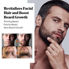 AVITAPURE aplicando minoxidil en la barba para absorción suave.