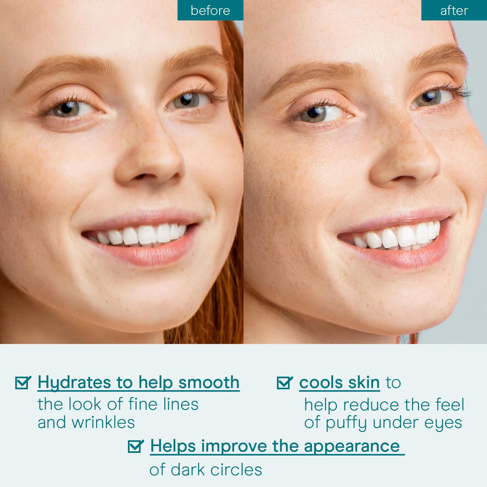 Close-up of Baebody Under-Eye Gel texture showing hydration.