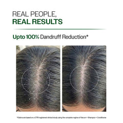 Dandruff flakes being washed away by Bare Anatomy Expert shampoo.
