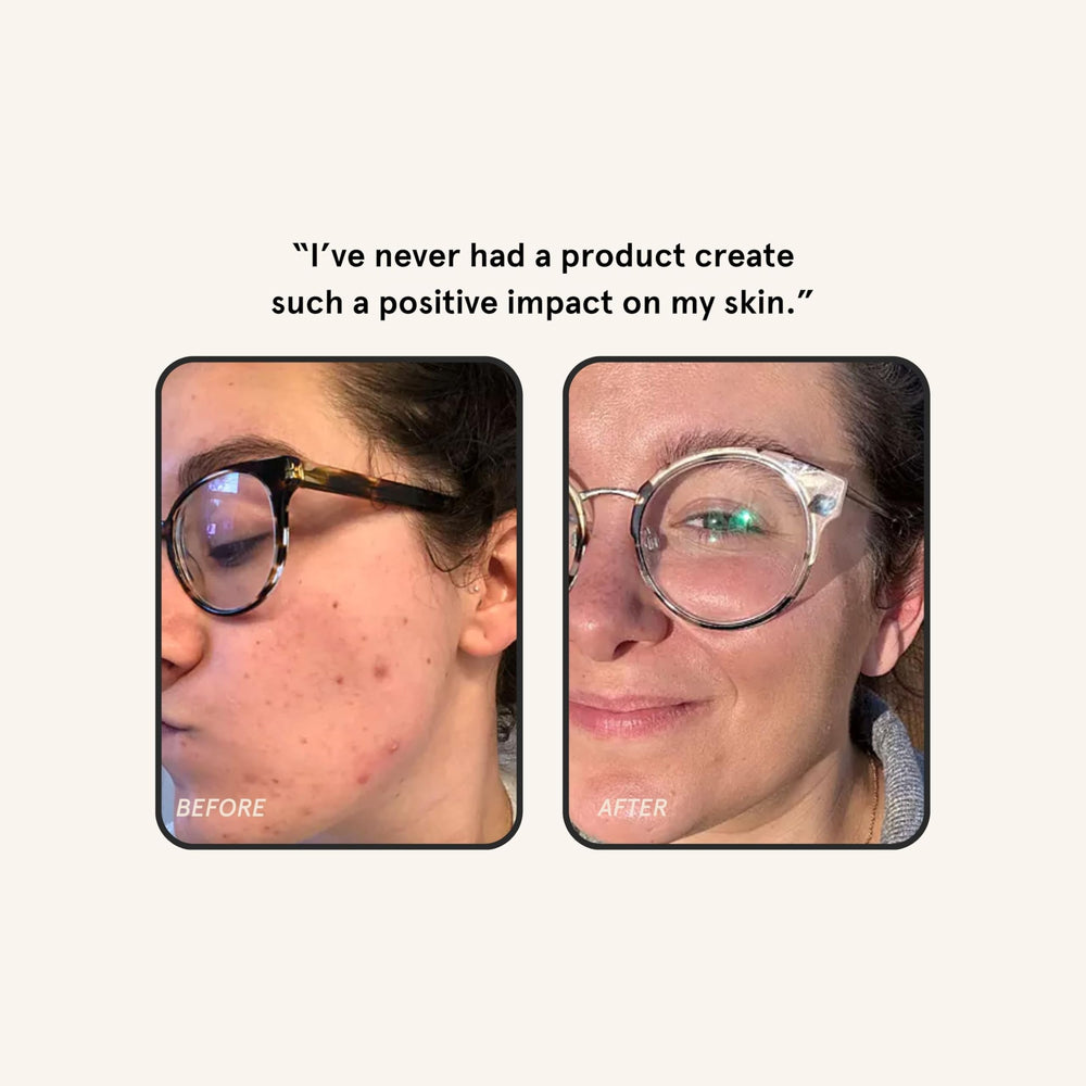 Barefaced Overachiever piel hidratada y saludable tras la aplicación.