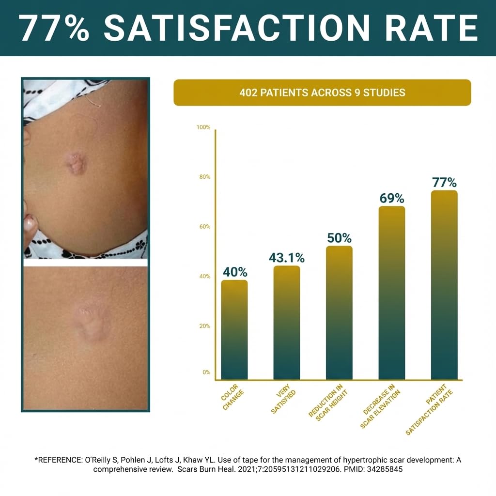 Beauty Buff silicona resistente al agua, uso 24/7 para cicatriz.