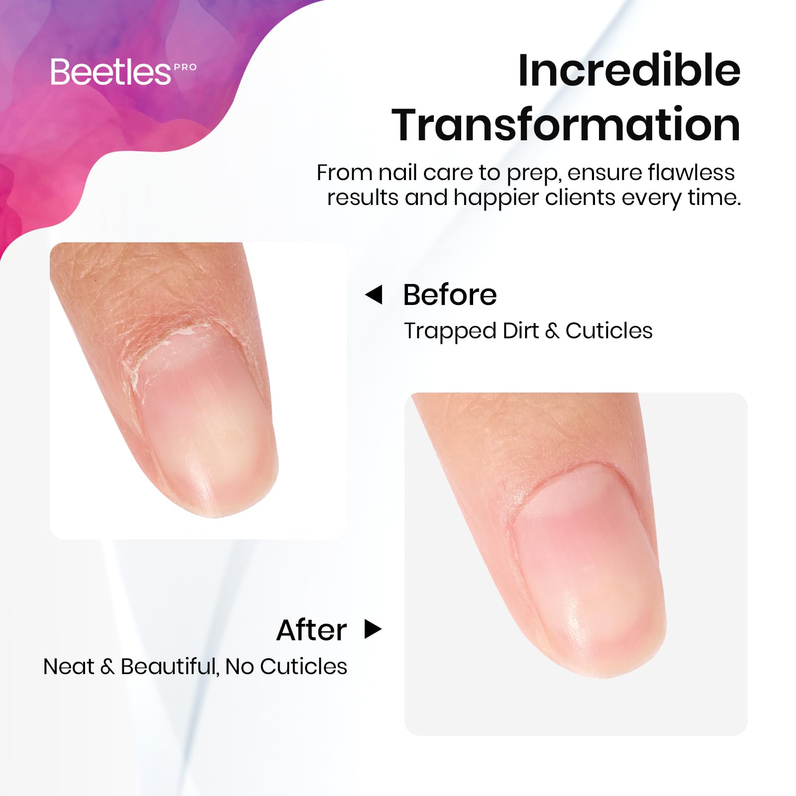 Beetles Pro uso en uñas acrilicas para forma precisa