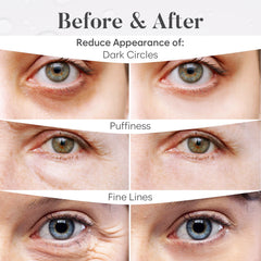 BLOOMORA Parches Ojos oro 24K para suavizar líneas finas