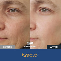 Breavo crema para ojos y ojeras, ayuda a crear un aspecto más fresco.