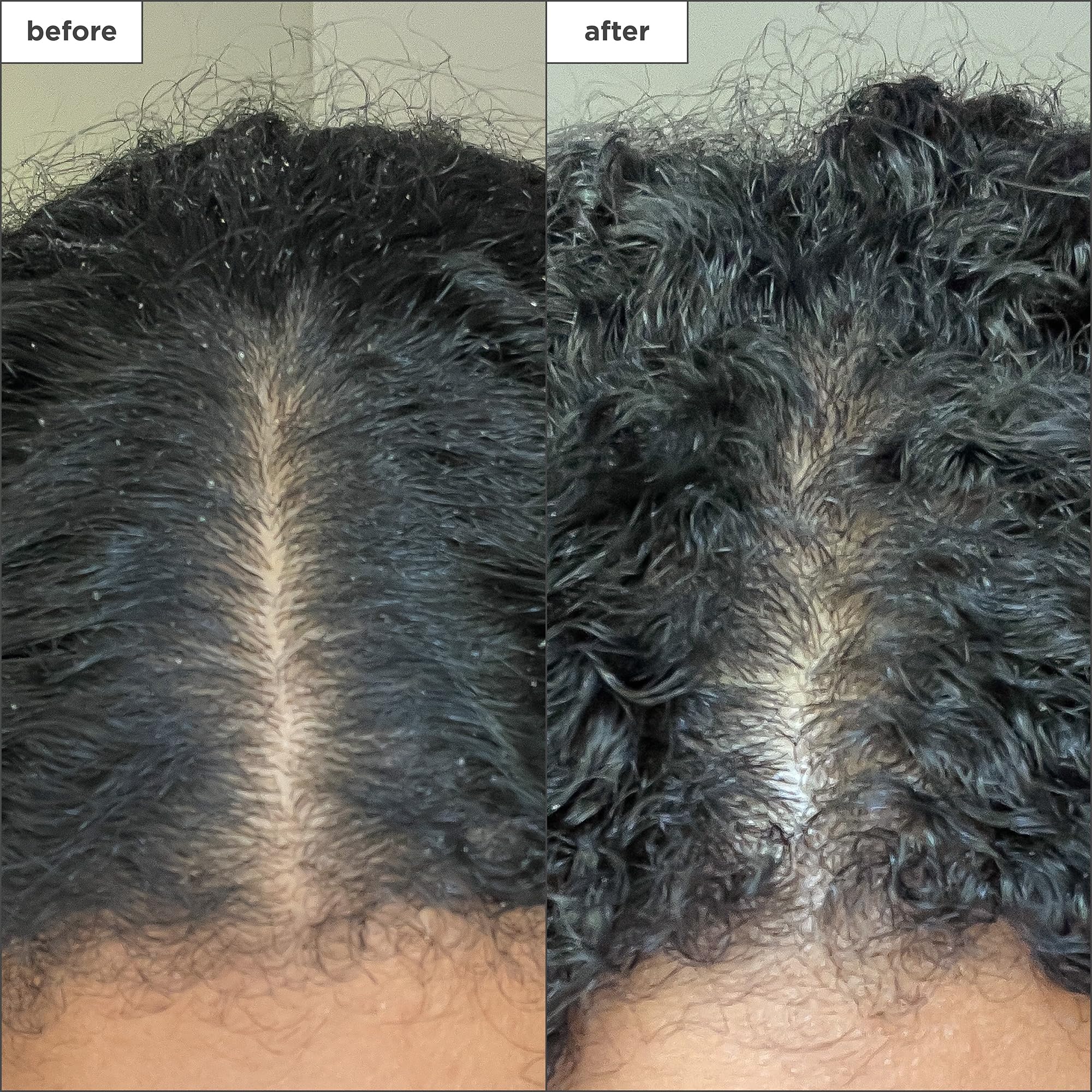 Briogeo Scalp Revival: frasco con complejo de menta, sensación fresca.
