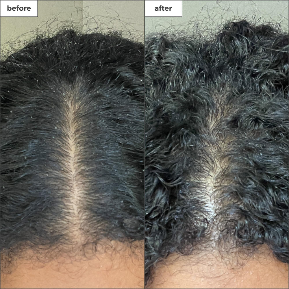 Briogeo Scalp Revival: frasco con complejo de menta, sensación fresca.