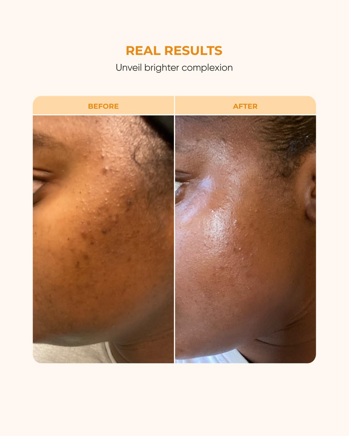 Buttah Vitamina C Serum, textura cremosa para hidratación suave.