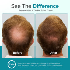 C'rcle Minoxidil Foam 5% absorción fácil y distribución uniforme.