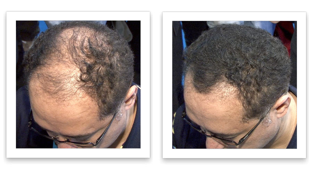 Caboki efecto antes y despues visible en fotos reales