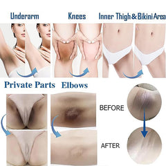 Ceavo crema aclaradora para axilas, piel más clara y tono uniforme.