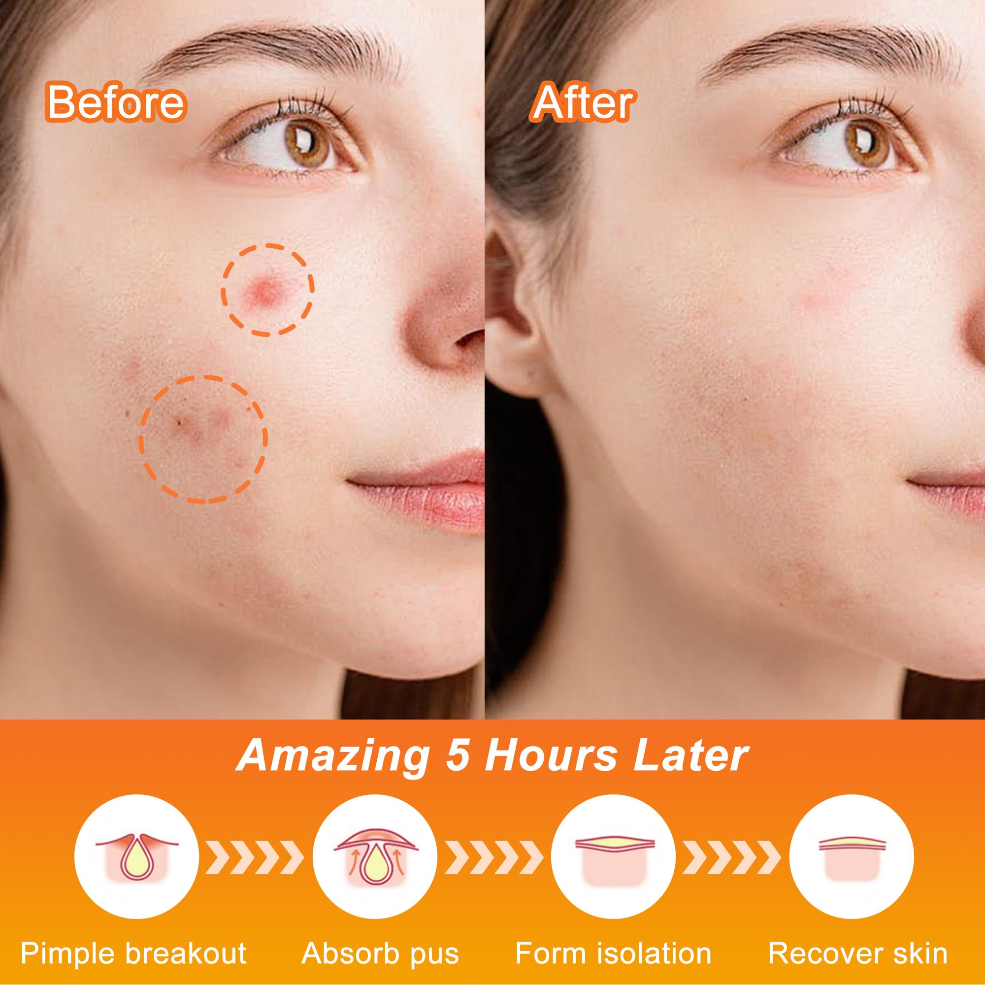 Celecare parches acne Halloween telaranas, cobertura rápida en zonas problemáticas.