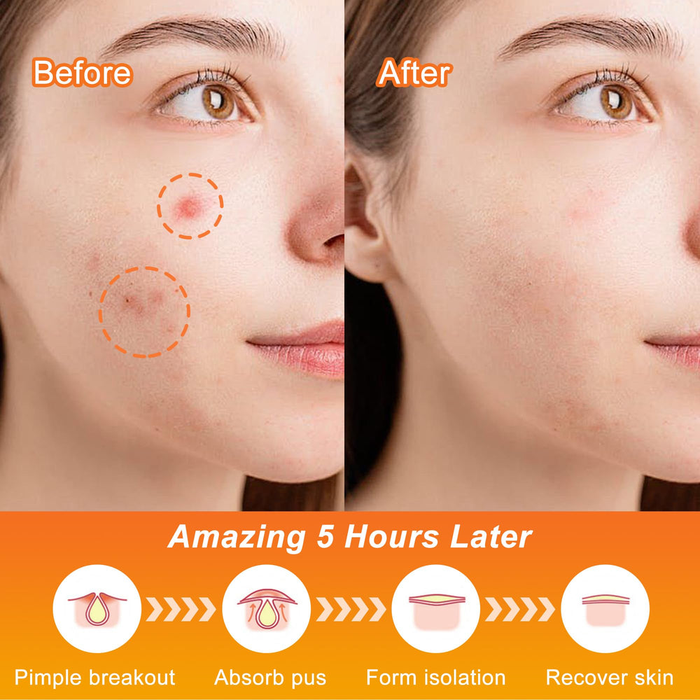 Celecare parches acne Halloween telaranas, cobertura rápida en zonas problemáticas.