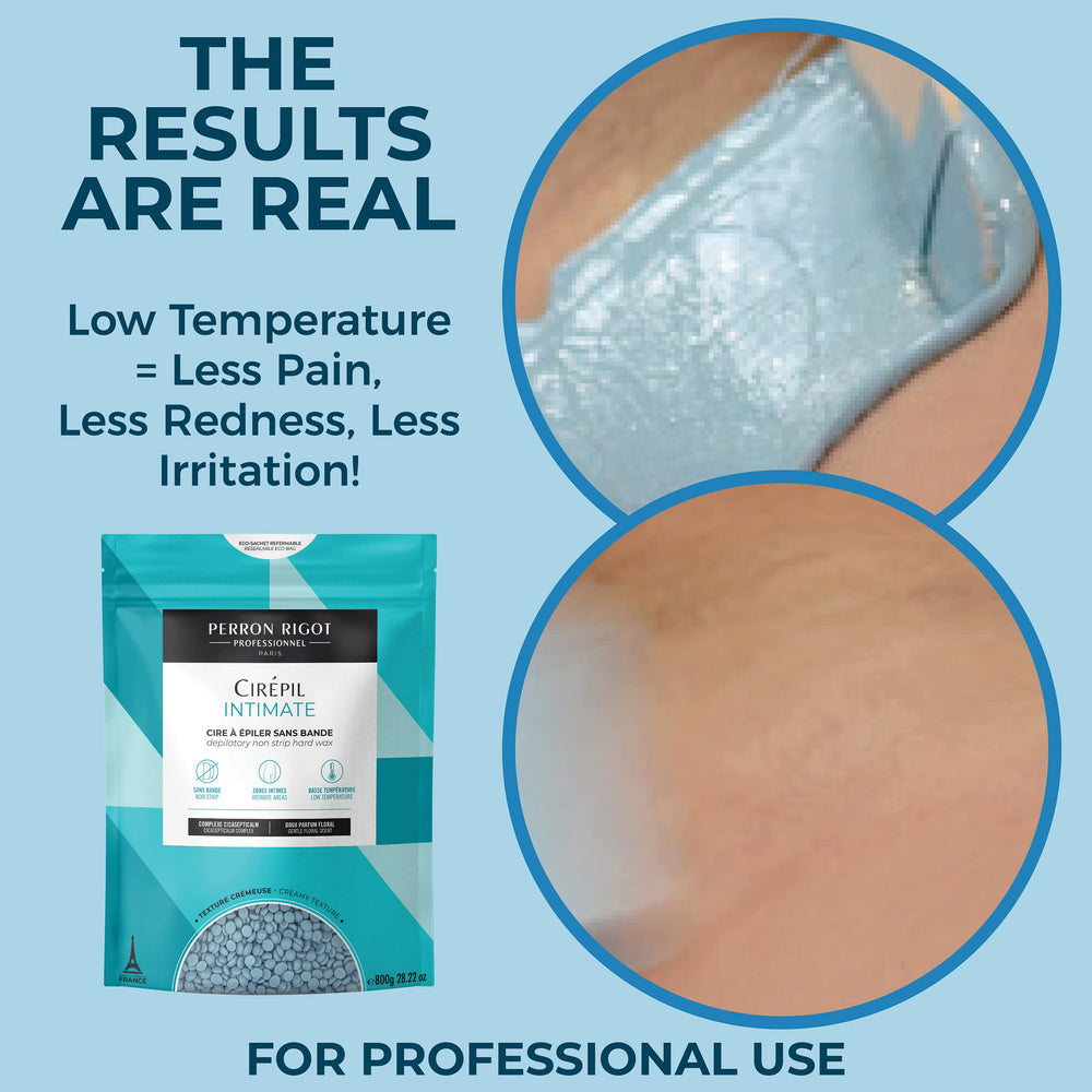 Cirepil Intimate, prueba dermatológica que favorece la tolerancia en piel sensible.