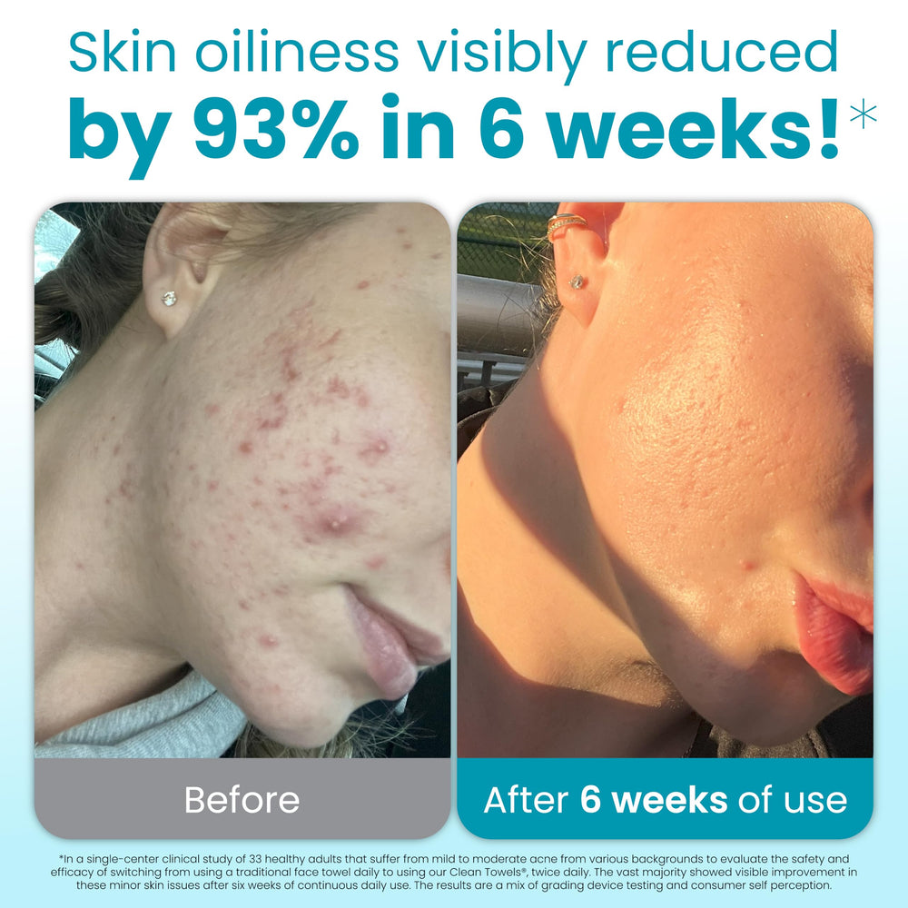 Toallita exfoliante de puntos de Clean Skin Club para una limpieza profunda diaria