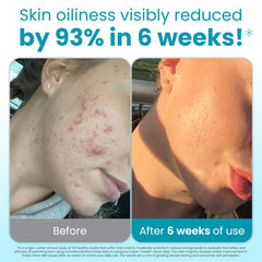 Toallita exfoliante de puntos de Clean Skin Club para una limpieza profunda diaria