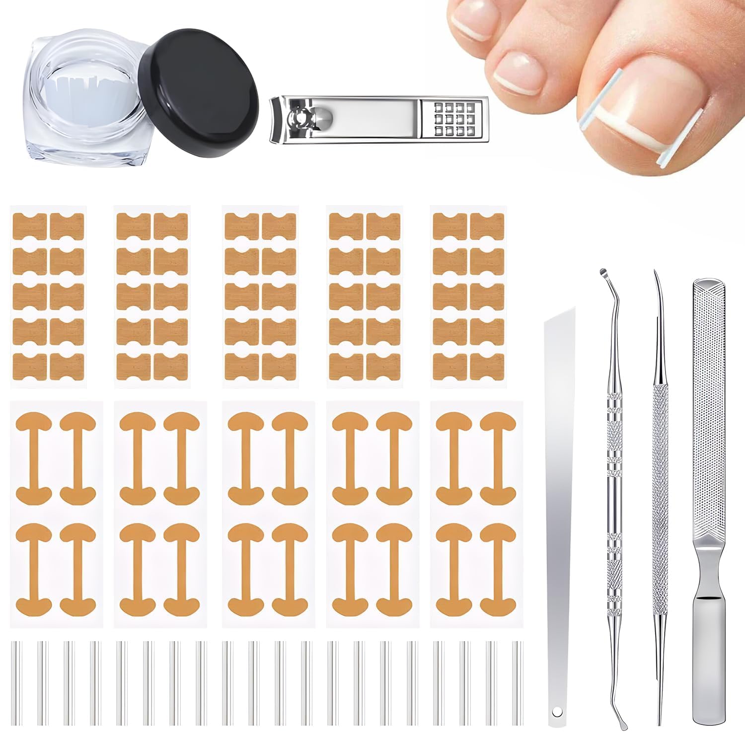 Conjunto Corrector Uñas Encarnadas: kit completo para cuidado en casa