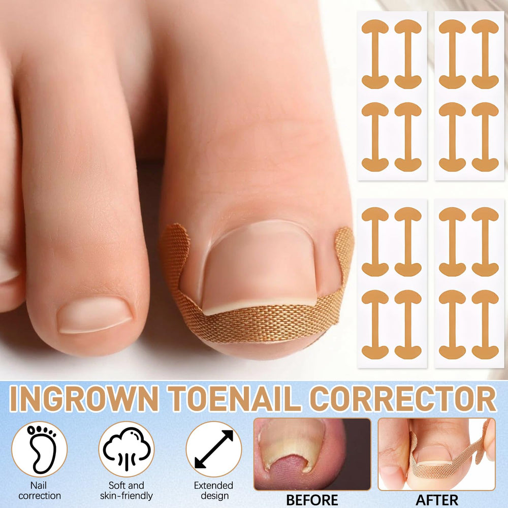 Conjunto Corrector Uñas Encarnadas: lima profesional para alisar bordes y evitar enganches