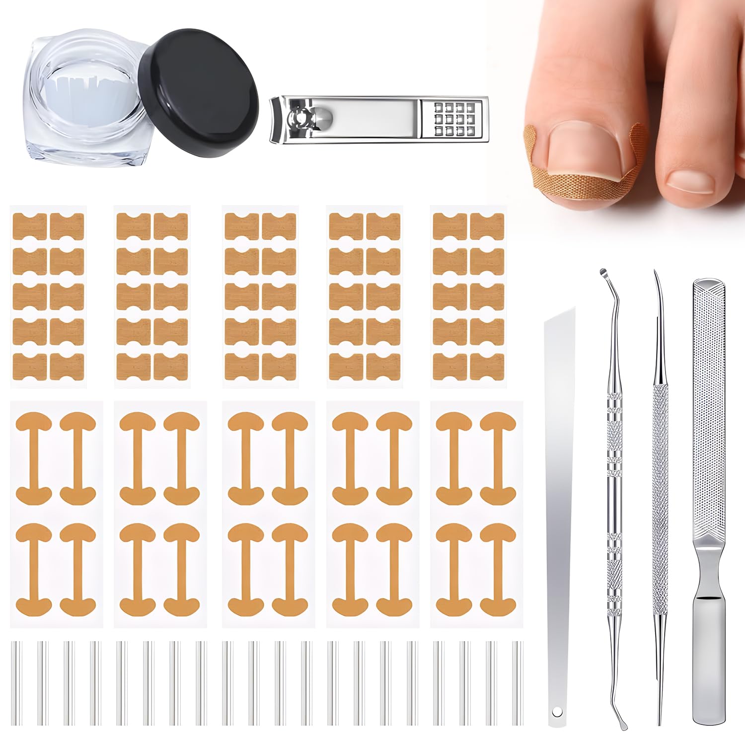 Conjunto Corrector Uñas Encarnadas: parche curvo para favorecer crecimiento suave