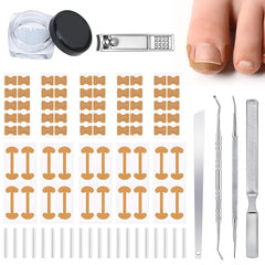 Conjunto Corrector Uñas Encarnadas: parche curvo para favorecer crecimiento suave
