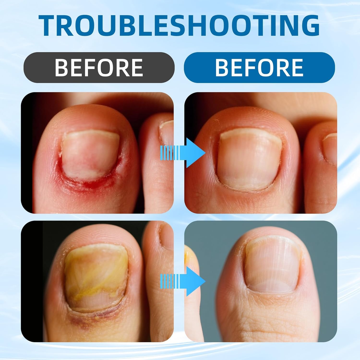 Corta uñas de acero inoxidable para un corte limpio