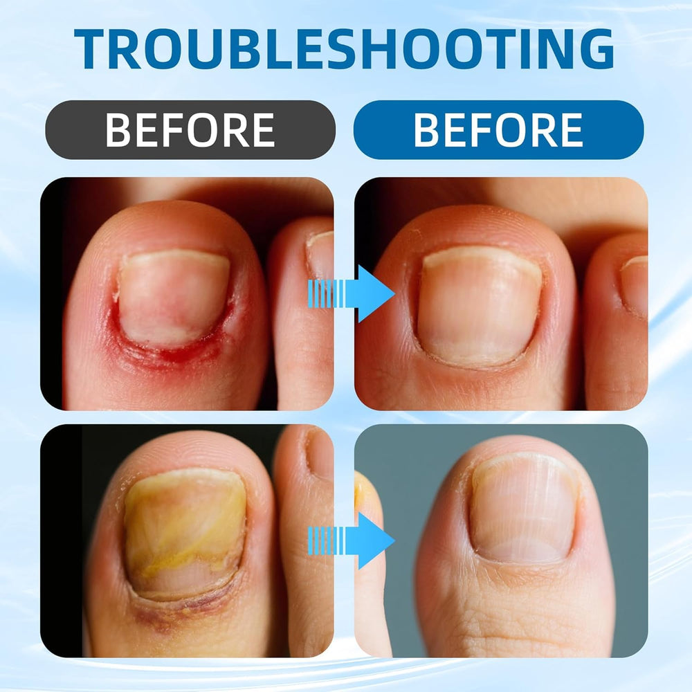 Corta uñas de acero inoxidable para un corte limpio